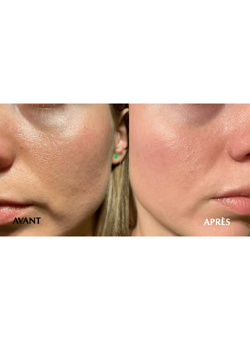 Arctic Booster Mask