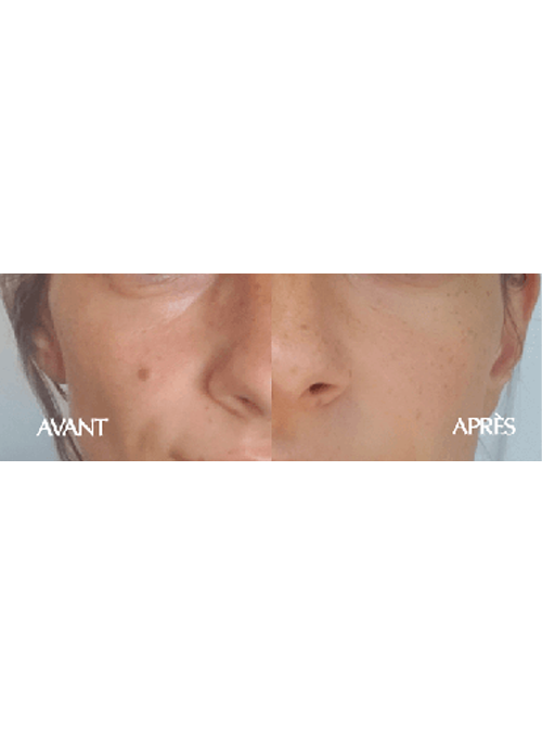 Illuminating Face Lotion