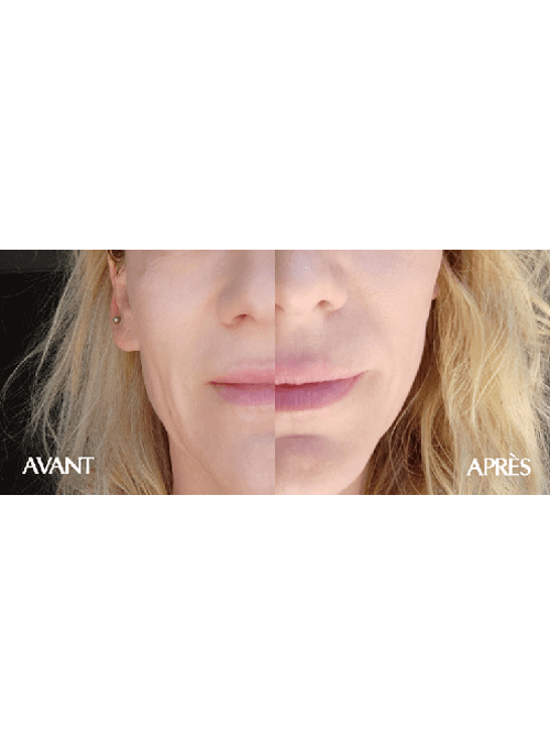 Anti Aging Face Mask
