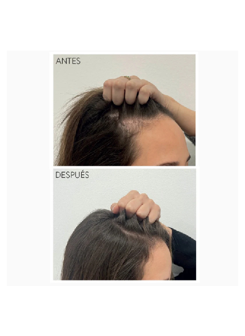 Rapunhair