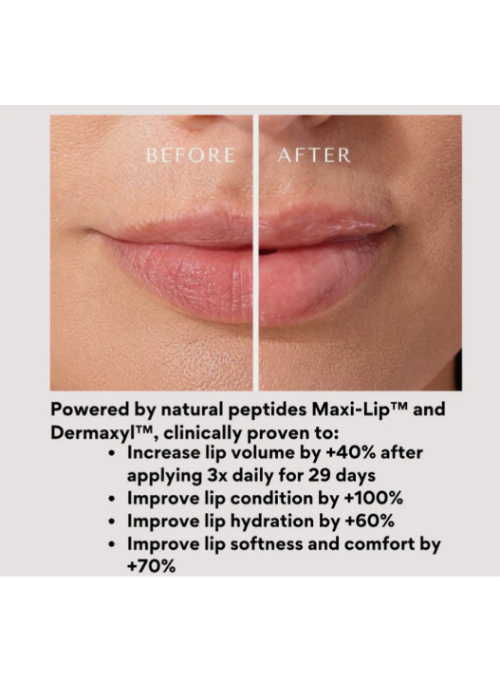  Lip Flip Treatment Balm