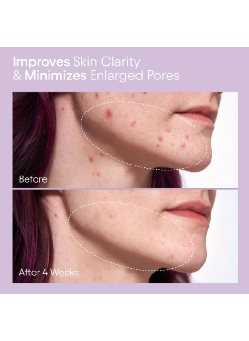 Clear Skin Set