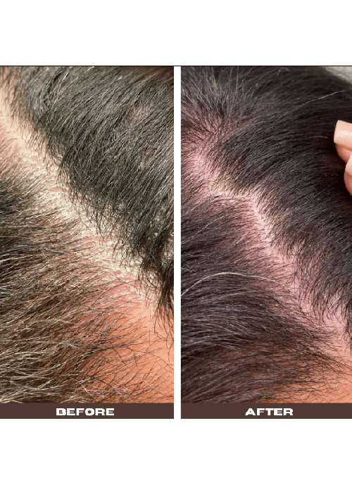 Scalp & Facial Solution Bundle