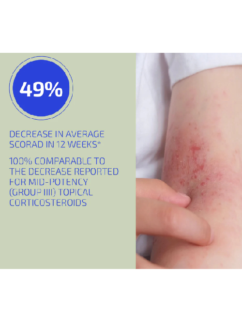 Eczema/Flare-Up Relief Set