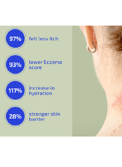 Eczema/Flare-Up Relief Set