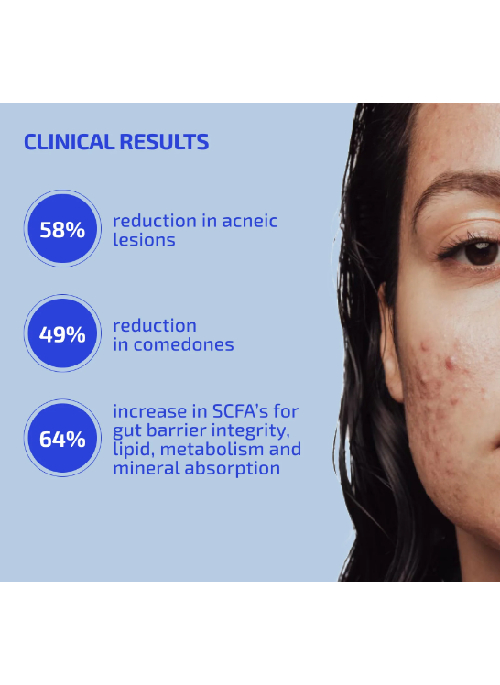 Probiotic Acne Supplement
