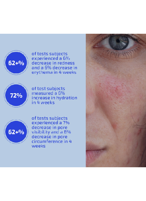 Balancing Refining Toner