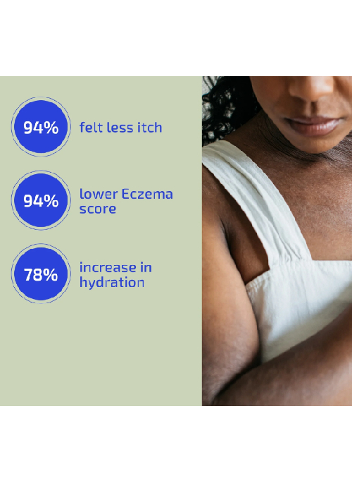 Eczema Relief Lotion