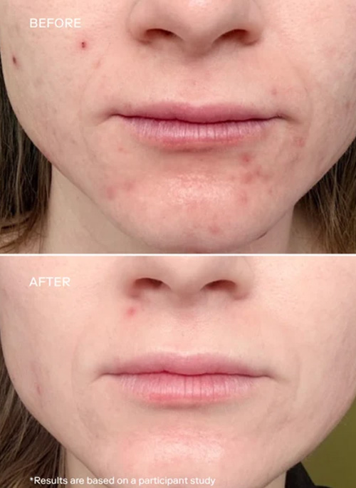 Skin Longevity Complex Moisturizing Cream