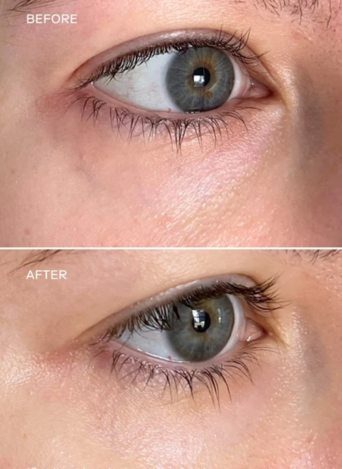 Revitalizing Eye Balm