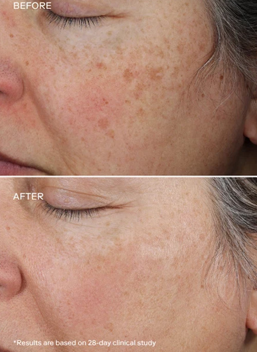 EXO PLUS® Anti-Aging Cream