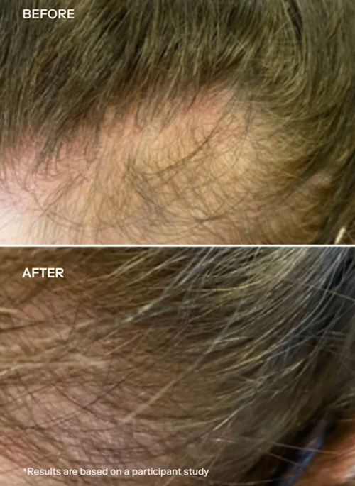 EXO FORTIFY™ Revitalizing Hair & Scalp Treatment