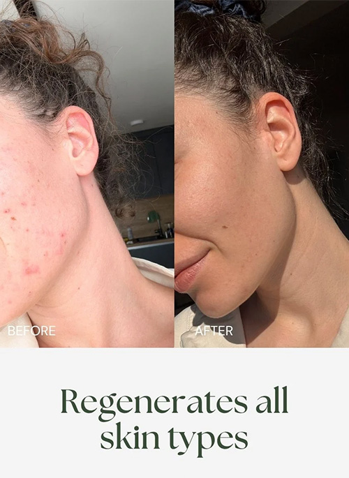 ABSOLUTE BERRY Bio Retinol Face Oil
