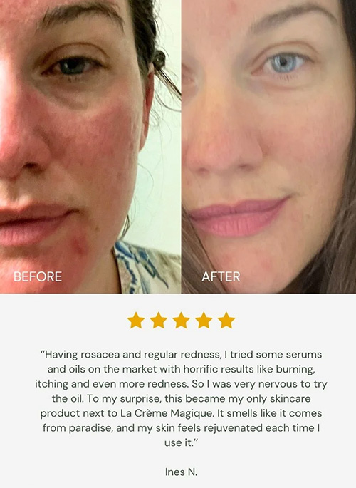ABSOLUTE BERRY Bio Retinol Face Oil