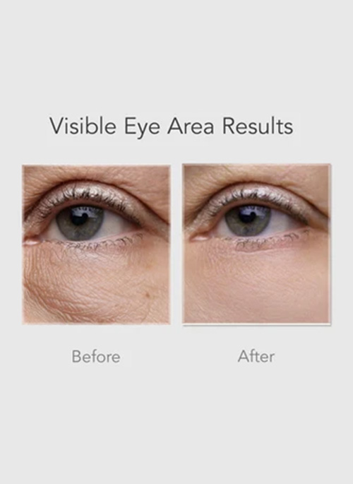 PDRN+ 2% Flat Eyebag Cream